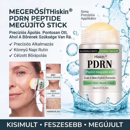 𝑯𝒊𝒔𝒌𝒊𝒏® 🛒 𝑷𝑫𝑹𝑵 Ö𝒓𝒆𝒈𝒆𝒅é𝒔𝒈á𝒕𝒍ó & 𝑪é𝒍𝒛𝒐𝒕𝒕 𝑭𝒐𝒍𝒕𝒎𝒆𝒈ú𝒋í𝒕ó 𝑺𝒕𝒊𝒇𝒕（𝑺𝒆𝒈í𝒕 𝒌𝒊𝒔𝒊𝒎í𝒕𝒂𝒏𝒊 𝒂 𝒓á𝒏𝒄𝒐𝒌 𝒎𝒆𝒈𝒋𝒆𝒍𝒆𝒏é𝒔é𝒕, 𝒕á𝒎𝒐𝒈𝒂𝒕𝒋𝒂 𝒂 𝒇𝒆𝒔𝒛𝒆𝒔𝒆𝒃𝒃𝒏𝒆𝒌 𝒕ű𝒏ő 𝒃ő𝒓𝒕, é𝒔 𝒔𝒆𝒈í𝒕 𝒋𝒂𝒗í𝒕𝒂𝒏𝒊 𝒂 𝒍á𝒕𝒉𝒂𝒕ó 𝒇𝒐𝒍𝒕𝒐𝒌 𝒎𝒆𝒈𝒋𝒆𝒍𝒆𝒏é𝒔é𝒕）✨
