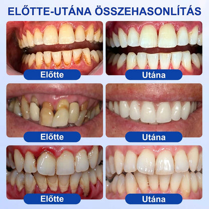 𝑬𝒗𝒐𝒍𝒗𝒊𝒐𝒏® 🦷 GumRevive Ínyregeneráló Gél – Az egészségesebb ínyért és magabiztosabb mosolyért🍄