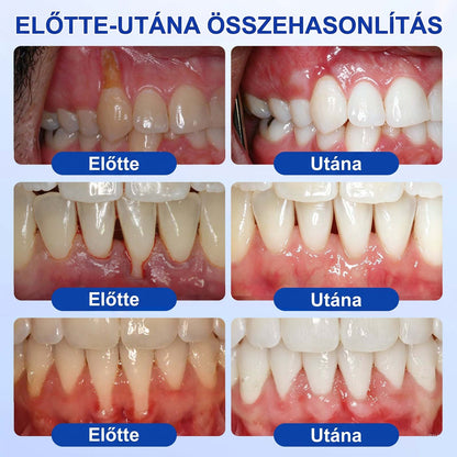 𝑬𝒗𝒐𝒍𝒗𝒊𝒐𝒏®🦷 GumRevive Ínyregeneráló Gél – Az egészségesebb ínyért és magabiztosabb mosolyért 🥰