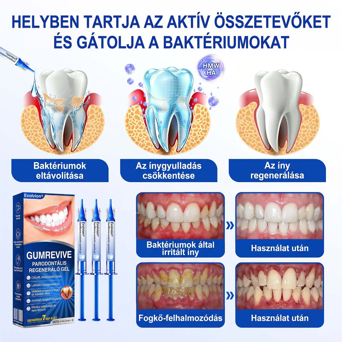 𝑬𝒗𝒐𝒍𝒗𝒊𝒐𝒏® 🦷 GumRevive Ínyregeneráló Gél – Az egészségesebb ínyért és magabiztosabb mosolyért🌷
