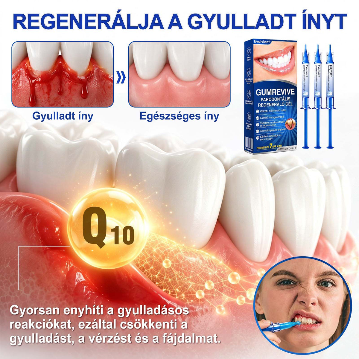 𝑬𝒗𝒐𝒍𝒗𝒊𝒐𝒏®🦷𝑮𝒖𝒎𝑹𝒆𝒗𝒊𝒗𝒆 Í𝒏𝒚𝒓𝒆𝒈𝒆𝒏𝒆𝒓á𝒍ó 𝑮é𝒍 – 𝑨𝒛 𝒆𝒈é𝒔𝒛𝒔é𝒈𝒆𝒔𝒆𝒃𝒃 í𝒏𝒚é𝒓𝒕 é𝒔 𝒎𝒂𝒈𝒂𝒃𝒊𝒛𝒕𝒐𝒔𝒂𝒃𝒃 𝒎𝒐𝒔𝒐𝒍𝒚é𝒓𝒕🌿