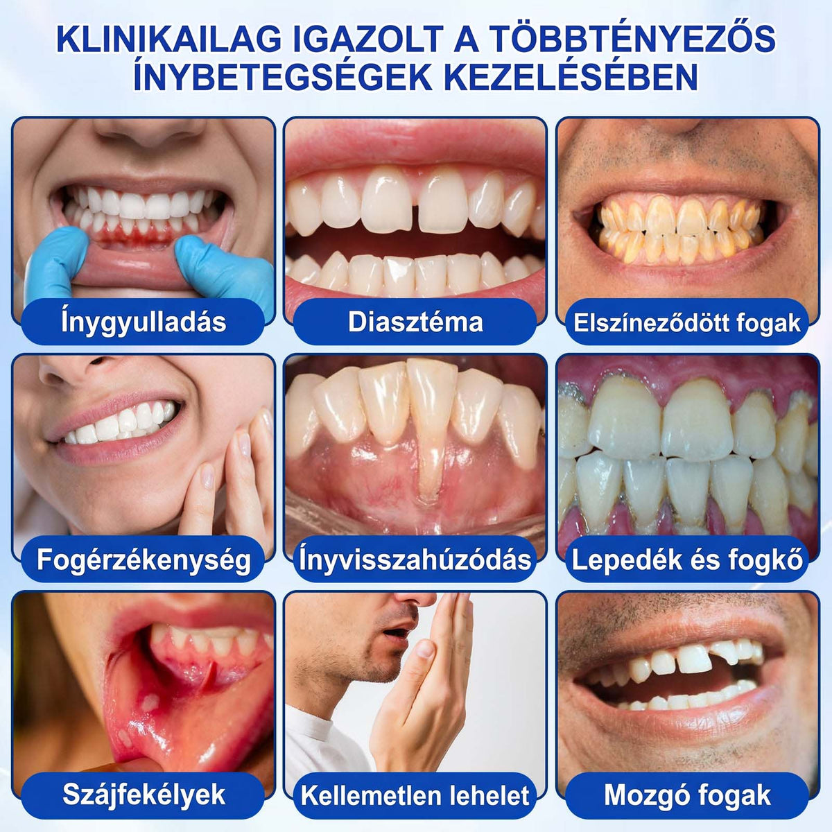 𝑬𝒗𝒐𝒍𝒗𝒊𝒐𝒏® 🦷 GumRevive Ínyregeneráló Gél – Az egészségesebb ínyért és magabiztosabb mosolyért🌷