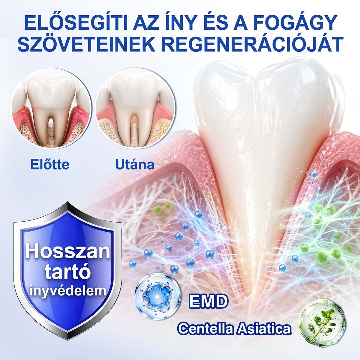 𝑬𝒗𝒐𝒍𝒗𝒊𝒐𝒏®🦷𝑮𝒖𝒎𝑹𝒆𝒗𝒊𝒗𝒆 Í𝒏𝒚𝒓𝒆𝒈𝒆𝒏𝒆𝒓á𝒍ó 𝑮é𝒍 – 𝑨𝒛 𝒆𝒈é𝒔𝒛𝒔é𝒈𝒆𝒔𝒆𝒃𝒃 í𝒏𝒚é𝒓𝒕 é𝒔 𝒎𝒂𝒈𝒂𝒃𝒊𝒛𝒕𝒐𝒔𝒂𝒃𝒃 𝒎𝒐𝒔𝒐𝒍𝒚é𝒓𝒕🌿