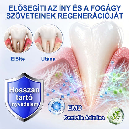 𝑬𝒗𝒐𝒍𝒗𝒊𝒐𝒏® 🦷 GumRevive Ínyregeneráló Gél – Az egészségesebb ínyért és magabiztosabb mosolyért🍄