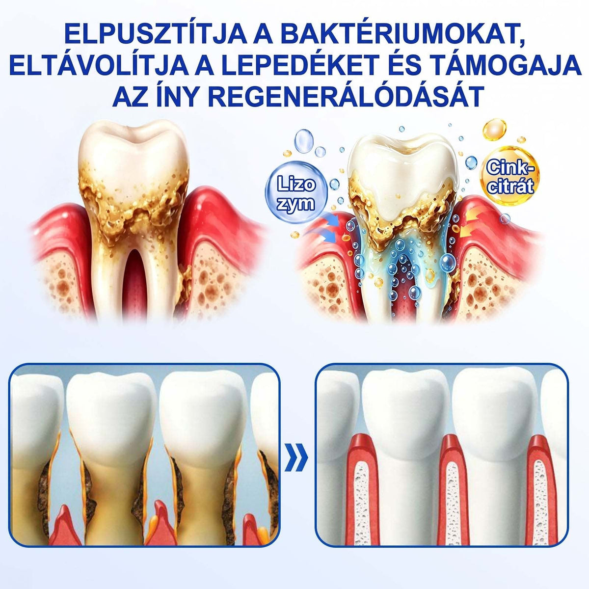 𝑬𝒗𝒐𝒍𝒗𝒊𝒐𝒏® 🦷 GumRevive Ínyregeneráló Gél – Az egészségesebb ínyért és magabiztosabb mosolyért🌷