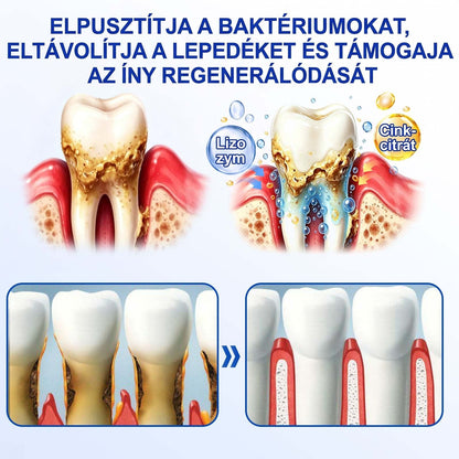 𝑬𝒗𝒐𝒍𝒗𝒊𝒐𝒏®🦷 GumRevive Ínyregeneráló Gél – Az egészségesebb ínyért és magabiztosabb mosolyért 🥰