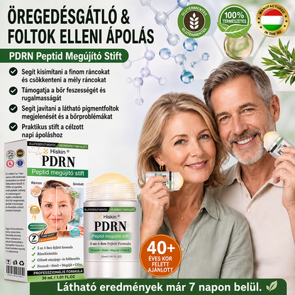 𝑯𝒊𝒔𝒌𝒊𝒏® 🛒 𝑷𝑫𝑹𝑵 Ö𝒓𝒆𝒈𝒆𝒅é𝒔𝒈á𝒕𝒍ó & 𝑪é𝒍𝒛𝒐𝒕𝒕 𝑭𝒐𝒍𝒕𝒎𝒆𝒈ú𝒋í𝒕ó 𝑺𝒕𝒊𝒇𝒕（𝑺𝒆𝒈í𝒕 𝒌𝒊𝒔𝒊𝒎í𝒕𝒂𝒏𝒊 𝒂 𝒓á𝒏𝒄𝒐𝒌 𝒎𝒆𝒈𝒋𝒆𝒍𝒆𝒏é𝒔é𝒕, 𝒕á𝒎𝒐𝒈𝒂𝒕𝒋𝒂 𝒂 𝒇𝒆𝒔𝒛𝒆𝒔𝒆𝒃𝒃𝒏𝒆𝒌 𝒕ű𝒏ő 𝒃ő𝒓𝒕, é𝒔 𝒔𝒆𝒈í𝒕 𝒋𝒂𝒗í𝒕𝒂𝒏𝒊 𝒂 𝒍á𝒕𝒉𝒂𝒕ó 𝒇𝒐𝒍𝒕𝒐𝒌 𝒎𝒆𝒈𝒋𝒆𝒍𝒆𝒏é𝒔é𝒕）✨