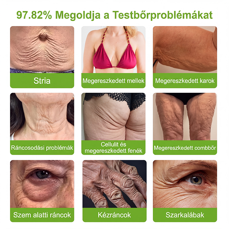 𝑯𝒊𝒔𝒌𝒊𝒏® 🛒 𝑷𝑫𝑹𝑵 Ö𝒓𝒆𝒈𝒆𝒅é𝒔𝒈á𝒕𝒍ó & 𝑪é𝒍𝒛𝒐𝒕𝒕 𝑭𝒐𝒍𝒕𝒎𝒆𝒈ú𝒋í𝒕ó 𝑺𝒕𝒊𝒇𝒕（𝑺𝒆𝒈í𝒕 𝒌𝒊𝒔𝒊𝒎í𝒕𝒂𝒏𝒊 𝒂 𝒓á𝒏𝒄𝒐𝒌 𝒎𝒆𝒈𝒋𝒆𝒍𝒆𝒏é𝒔é𝒕, 𝒕á𝒎𝒐𝒈𝒂𝒕𝒋𝒂 𝒂 𝒇𝒆𝒔𝒛𝒆𝒔𝒆𝒃𝒃𝒏𝒆𝒌 𝒕ű𝒏ő 𝒃ő𝒓𝒕, é𝒔 𝒔𝒆𝒈í𝒕 𝒋𝒂𝒗í𝒕𝒂𝒏𝒊 𝒂 𝒍á𝒕𝒉𝒂𝒕ó 𝒇𝒐𝒍𝒕𝒐𝒌 𝒎𝒆𝒈𝒋𝒆𝒍𝒆𝒏é𝒔é𝒕）✨