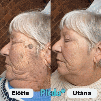 𝐏𝐢𝐜𝐝𝐨® 𝟕 𝐍𝐚𝐩𝐨𝐬 𝐓𝐚𝐠 𝐞́𝐬 𝐒𝐩𝐨𝐭 𝐄𝐥𝐭𝐚́𝐯𝐨𝐥𝐢́𝐭𝐨́ (𝐑𝐨𝐥𝐥-𝐨𝐧 𝐚𝐩𝐩𝐥𝐢𝐤𝐚́𝐭𝐨𝐫: 𝐟𝐚́𝐣𝐝𝐚𝐥𝐨𝐦 𝐞́𝐬 𝐡𝐞𝐠𝐞𝐤 𝐧𝐞́𝐥𝐤𝐮̈𝐥)🙏