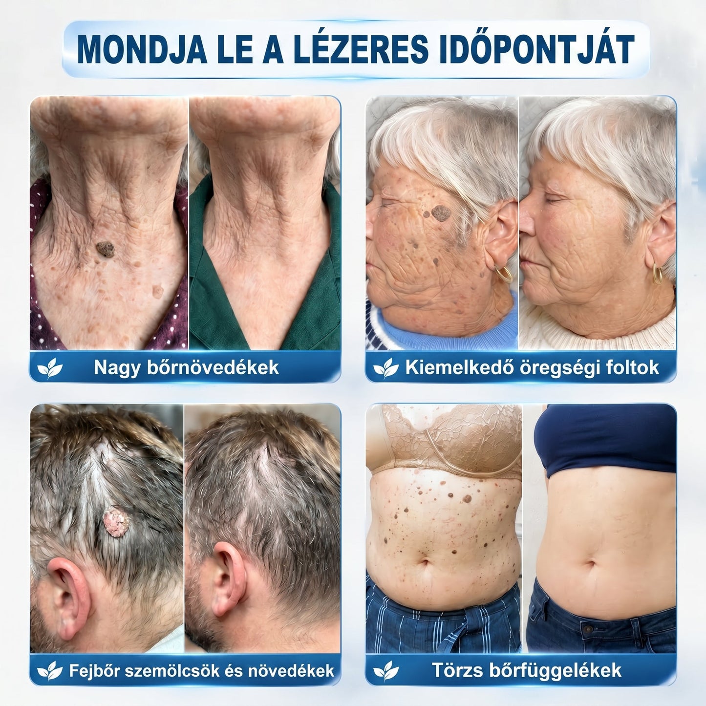 𝐏𝐢𝐜𝐝𝐨® 𝟕 𝐍𝐚𝐩𝐨𝐬 𝐓𝐚𝐠 𝐞́𝐬 𝐒𝐩𝐨𝐭 𝐄𝐥𝐭𝐚́𝐯𝐨𝐥𝐢́𝐭𝐨́ (𝐑𝐨𝐥𝐥-𝐨𝐧 𝐚𝐩𝐩𝐥𝐢𝐤𝐚́𝐭𝐨𝐫: 𝐟𝐚́𝐣𝐝𝐚𝐥𝐨𝐦 𝐞́𝐬 𝐡𝐞𝐠𝐞𝐤 𝐧𝐞́𝐥𝐤𝐮̈𝐥)🙏