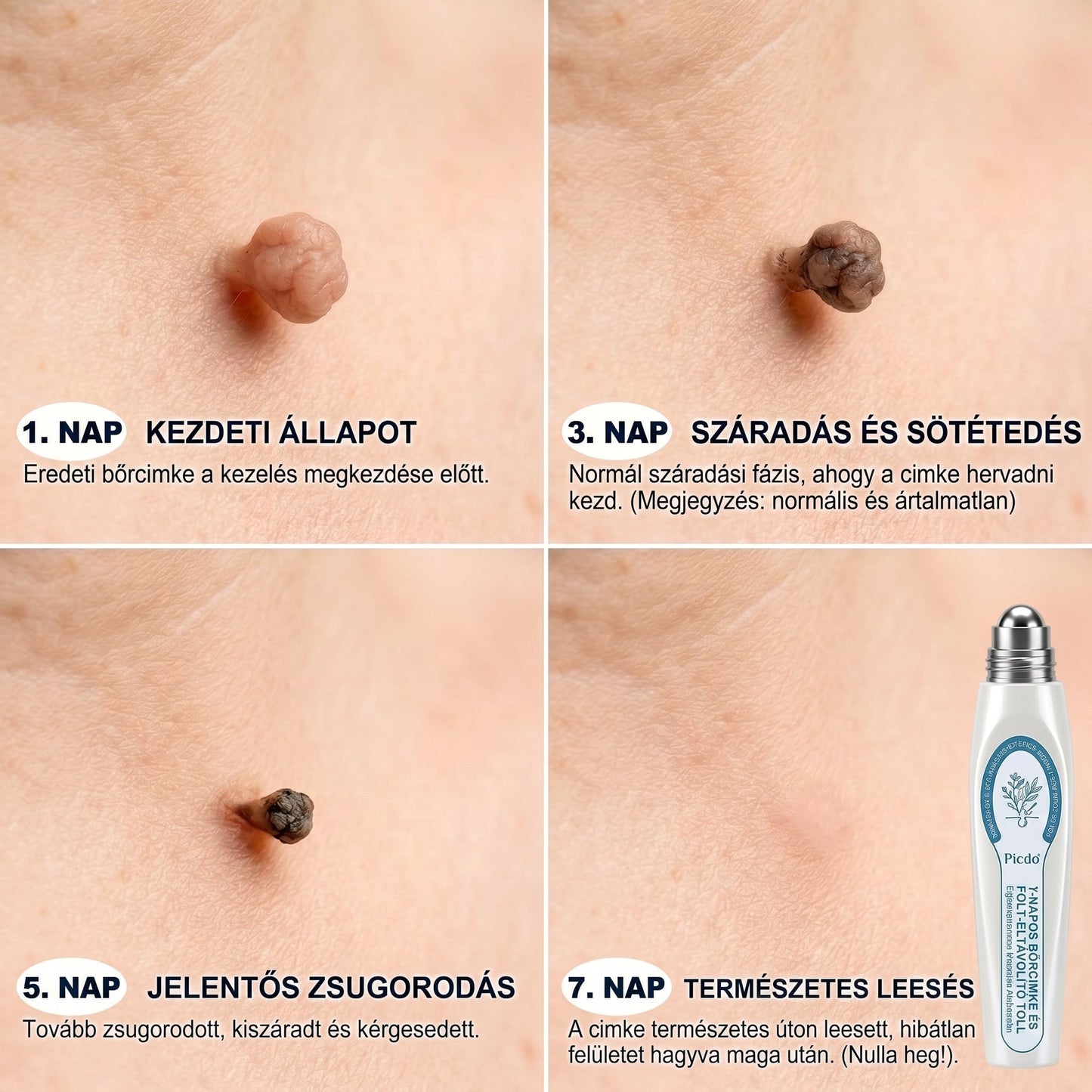 𝐏𝐢𝐜𝐝𝐨® 𝟕 𝐍𝐚𝐩𝐨𝐬 𝐓𝐚𝐠 𝐞́𝐬 𝐒𝐩𝐨𝐭 𝐄𝐥𝐭𝐚́𝐯𝐨𝐥𝐢́𝐭𝐨́ (𝐑𝐨𝐥𝐥-𝐨𝐧 𝐚𝐩𝐩𝐥𝐢𝐤𝐚́𝐭𝐨𝐫: 𝐟𝐚́𝐣𝐝𝐚𝐥𝐨𝐦 𝐞́𝐬 𝐡𝐞𝐠𝐞𝐤 𝐧𝐞́𝐥𝐤𝐮̈𝐥)🙏