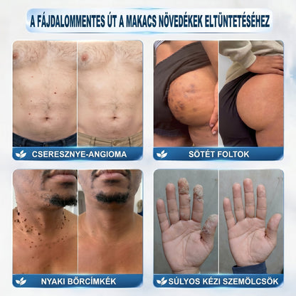 𝐏𝐢𝐜𝐝𝐨® 𝟕 𝐍𝐚𝐩𝐨𝐬 𝐓𝐚𝐠 𝐞́𝐬 𝐒𝐩𝐨𝐭 𝐄𝐥𝐭𝐚́𝐯𝐨𝐥𝐢́𝐭𝐨́ (𝐑𝐨𝐥𝐥-𝐨𝐧 𝐚𝐩𝐩𝐥𝐢𝐤𝐚́𝐭𝐨𝐫: 𝐟𝐚́𝐣𝐝𝐚𝐥𝐨𝐦 𝐞́𝐬 𝐡𝐞𝐠𝐞𝐤 𝐧𝐞́𝐥𝐤𝐮̈𝐥)🙏