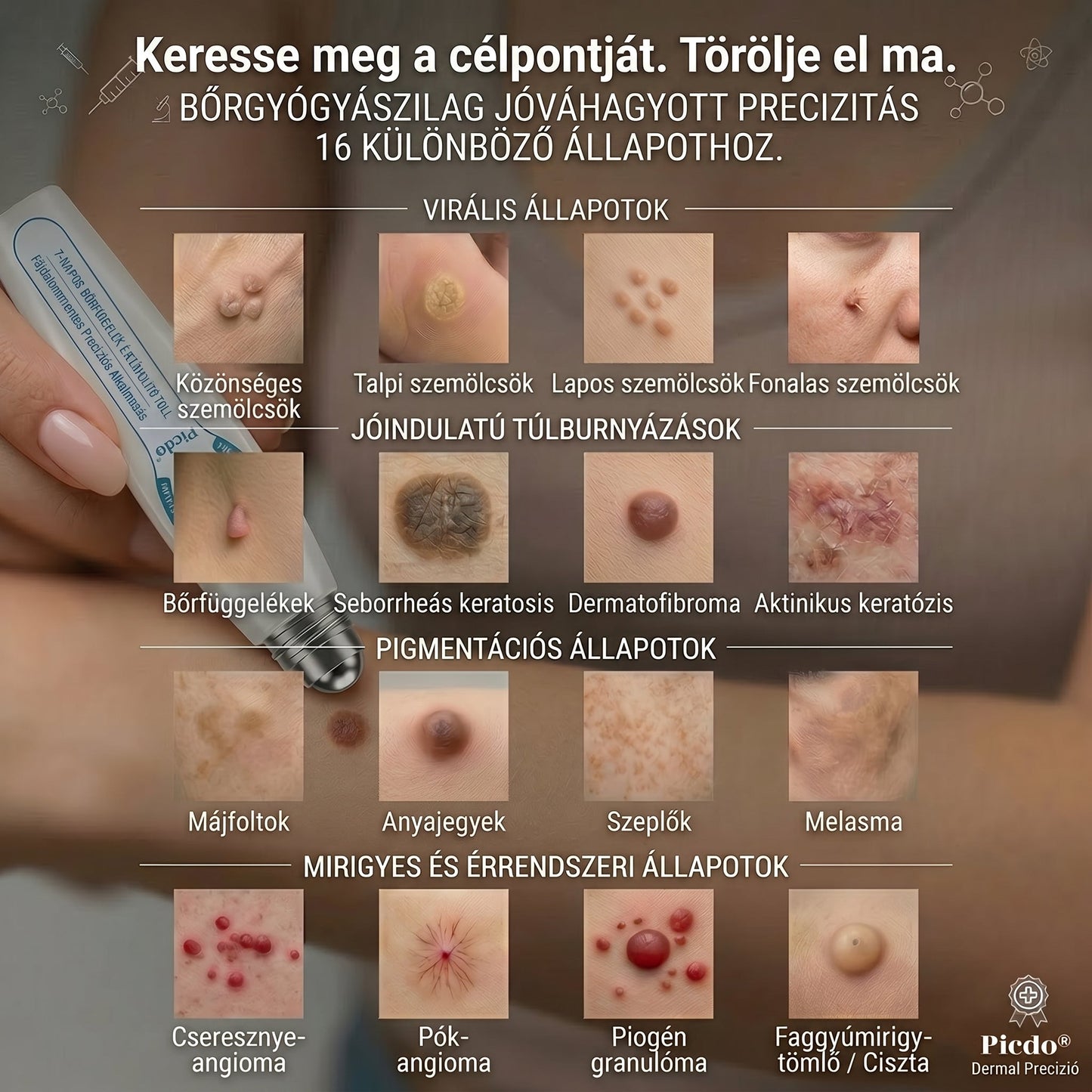 𝐏𝐢𝐜𝐝𝐨® 𝟕 𝐍𝐚𝐩𝐨𝐬 𝐓𝐚𝐠 𝐞́𝐬 𝐒𝐩𝐨𝐭 𝐄𝐥𝐭𝐚́𝐯𝐨𝐥𝐢́𝐭𝐨́ (𝐑𝐨𝐥𝐥-𝐨𝐧 𝐚𝐩𝐩𝐥𝐢𝐤𝐚́𝐭𝐨𝐫: 𝐟𝐚́𝐣𝐝𝐚𝐥𝐨𝐦 𝐞́𝐬 𝐡𝐞𝐠𝐞𝐤 𝐧𝐞́𝐥𝐤𝐮̈𝐥)🙏