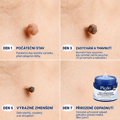 Picdo® 7‑denní krém k odstraňování kožních výrůstků a pigmentových skvrn 🧴(𝐒𝐜𝐡𝐦𝐞𝐫𝐳𝐟𝐫𝐞𝐢𝐞 𝐅𝐨𝐫𝐦𝐞𝐥 – 𝐨𝐡𝐧𝐞 𝐍𝐚𝐫𝐛𝐞𝐧) 🛡️